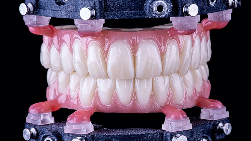 denbright-dental-labs-guided-surgery-workflows