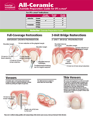 IPS-emax_Prep_Guide-1